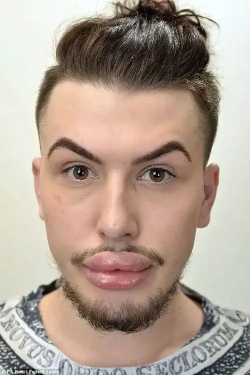 我最开始被整容手术所吸引,完全是为了我的灵感缪思玛丽莲梦露
