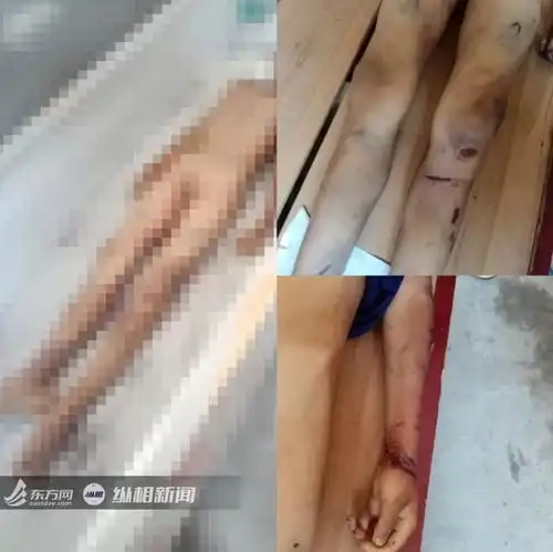 12岁男童遭虐打致死,其父母已被刑拘
