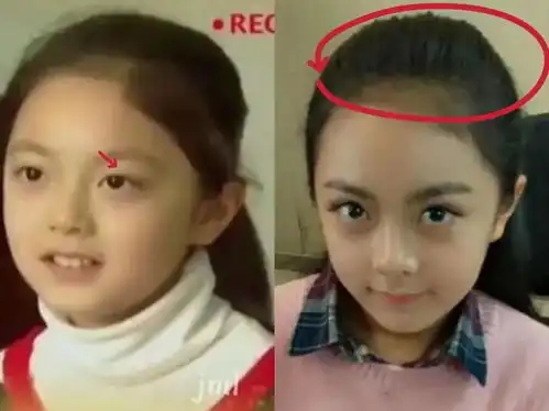 终于开挂了,这鼻子吊打所有现役小花
