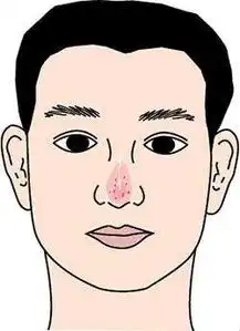 女的嫁了这五种长相的男的要倒霉一辈子

