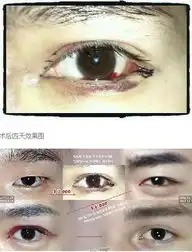 大叔变成超级明星脸韩整容过程全曝光
