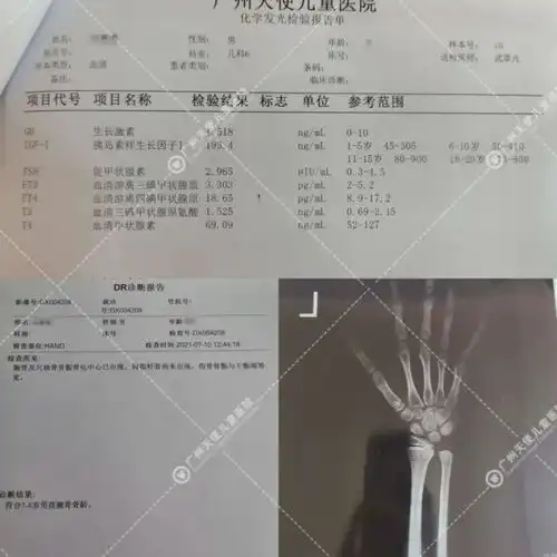 11岁班上最矮男孩,两个月逆袭长高3cm,终于弯道超车啦
