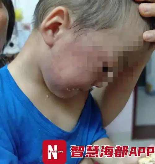 因不睡午觉2岁男童两分钟遭老师掌掴8次
