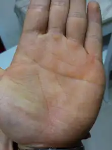 男人左手断掌好吗
