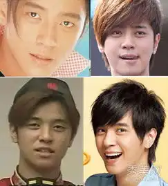 郭敬明黄晓明娱乐圈男星整容不手软
