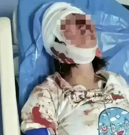 挑逗不成就暴打,唐山这10天都发生了什么最全烧烤店来龙去脉
