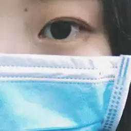 大龄女青年,牙齿正畸并拔牙的过程和感觉
