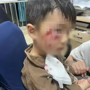 河南3岁男童被恶犬咬伤18天后不幸离世,男童母亲发声
