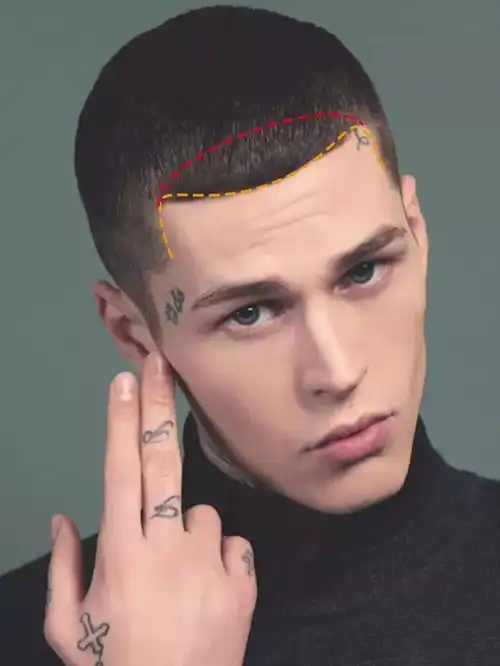 头发少发际线高如何通过造型在视觉上改善头发问题
