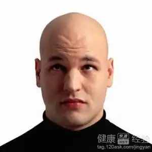 如何快速有效预防脱发
