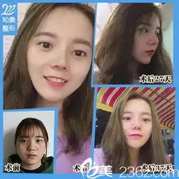 薛凯个人主页东莞南城知美整形美佳网
