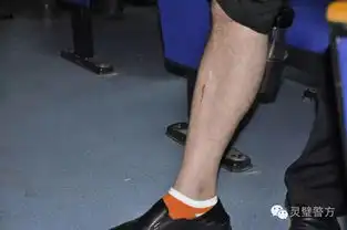男子飞车抢夺被抓蜀黍支招如何防范飞车抢夺
