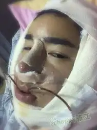大叔变成超级明星脸韩整容过程全曝光
