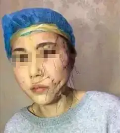 抖音网红为变明星整容,女的八年整成杨幂,老公变成低配李易峰
