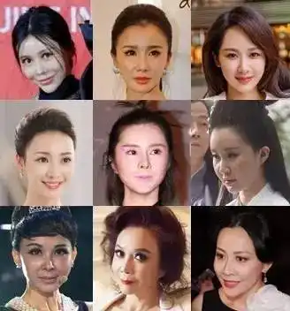 这些女明星都逃不出蔡明魔咒,都怪玻尿酸打多了不好意思,这锅咱不背
