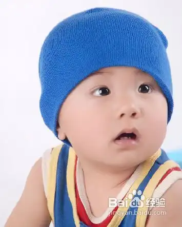 小儿菌痢疾是由什么引起的
