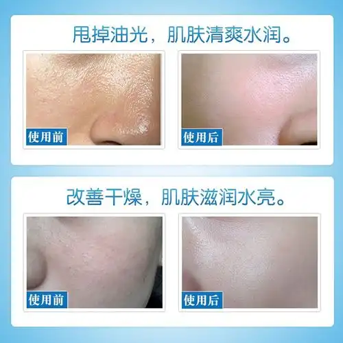 收缩毛孔精华液修复男女士毛孔粗大面部保湿细致补水
