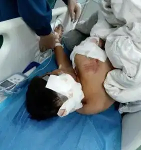 111湖南男童遭大型犬咬伤事件
