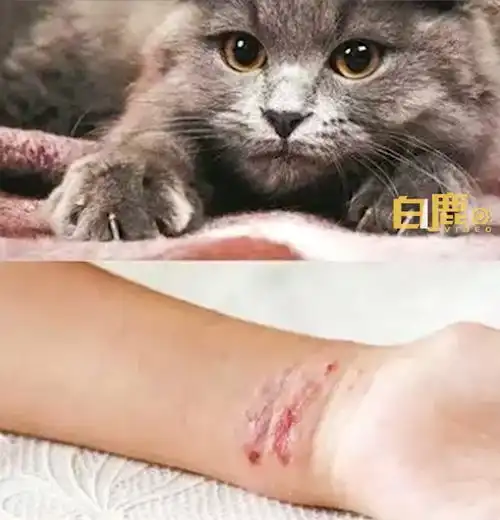1岁男孩被小猫抓伤,半个月来反复发烧,医生这是感染了猫抓病
