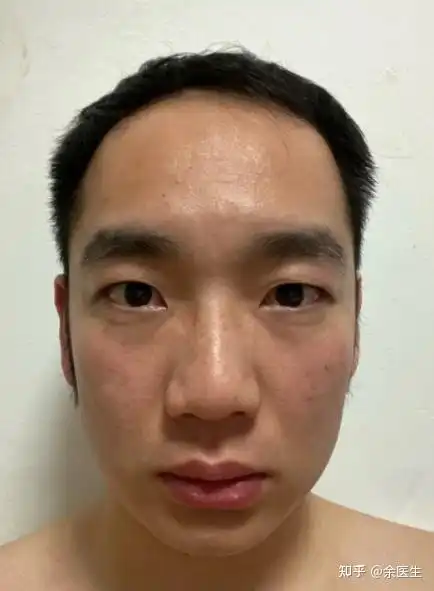 从医学的角度来说,男性到底该如何延缓衰老
