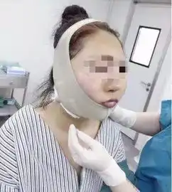 抖音网红为变明星整容,女的八年整成杨幂,老公变成低配李易峰
