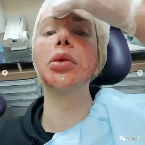 英国白男砸百万整容18次,只为追星当韩国人我太爱他了
