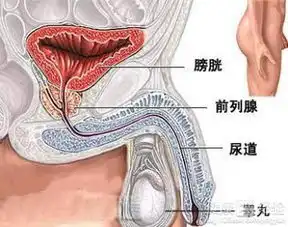 膀胱癌早期转移症状表现
