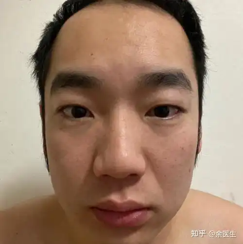 从医学的角度来说,男性到底该如何延缓衰老
