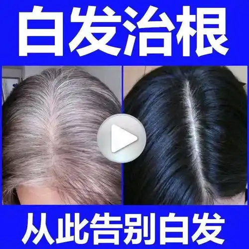 白发变黑发何首乌洗发水中草药黑发乌发男女老年少年产后白发防脱