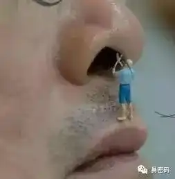 这些坏习惯正在不断损害着你的鼻腔
