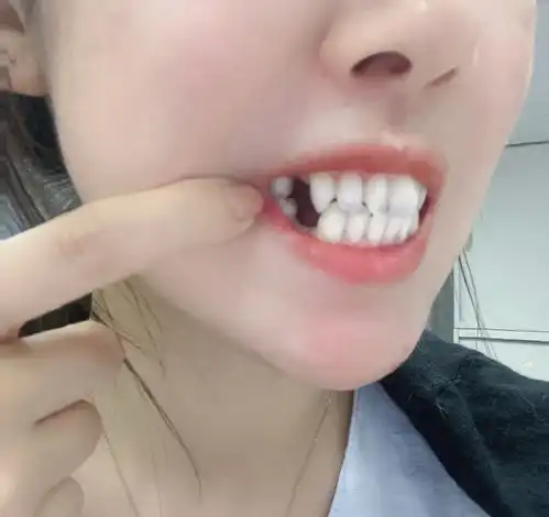 女性三个时期不适宜拔牙
