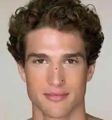 面相长痣需谨防健康有隐患
