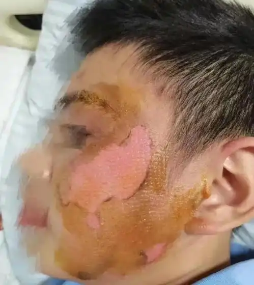 我把你孩子弄毁容了,我还不是什么事都没有你能拿我怎样