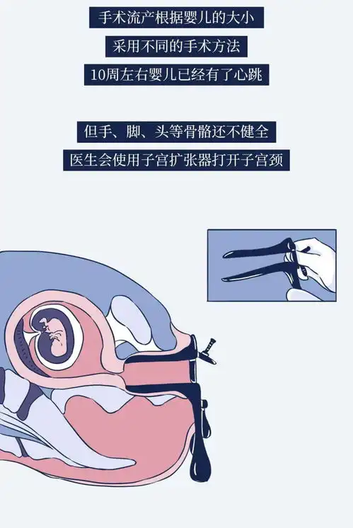 避孕失败,到底有多大危害
