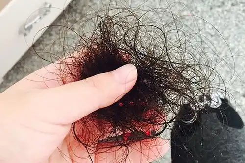 鼻毛变白,是提示身体在变老其实另有原因,男性多留意下
