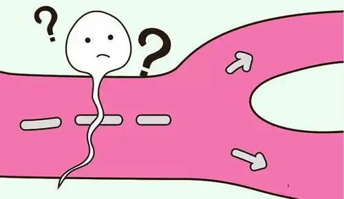 男性精子杀手附睾炎
