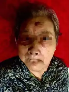 丧心病狂年轻男子街头暴打87岁老奶奶,只因老人一句善意提醒警方该男子因涉嫌寻衅滋事罪已被刑拘
