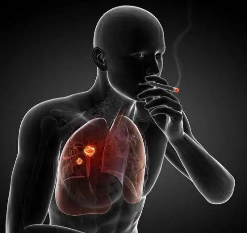 男性晨起后2个行为,比吸烟还伤肺,劝你尽早远离为好
