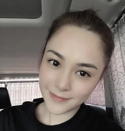 祝福阿娇受伤后首晒伤口照报平安,眉骨留下近5厘米伤痕
