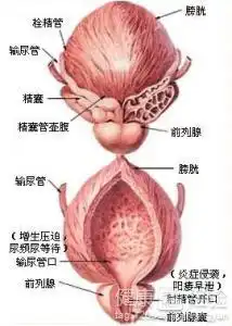 慢性前列腺炎是否久坐引起的
