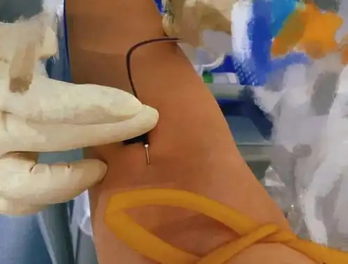 真人投稿陪我走出抑郁的前男友,感染了艾滋
