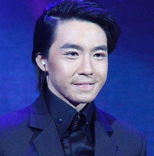 8位整容男星,有的整成真人版马里奥,有的为戏整容令人惋惜
