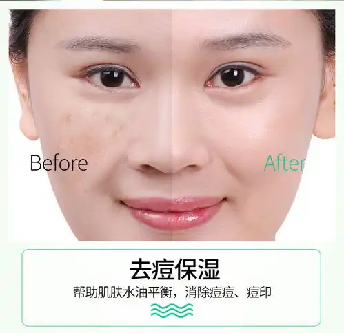 芦荟胶淡化印补水保湿收缩毛孔晒后女男正品自然修复
