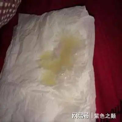 全球男性精子量告急,男子违规疯狂捐精,成为至少550名孩子父亲
