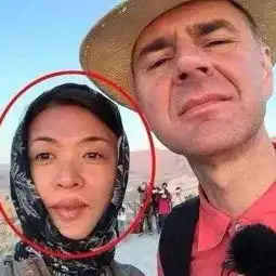 51岁的金星后遗症越来越严重,丈夫很尴尬她会再次手术吗
