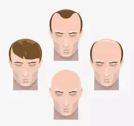 男性开始衰老时,身体会出现3低2大,一个不占,你就偷着乐吧