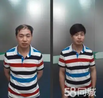 广州假发套透气吗广州假发套和事发制品
