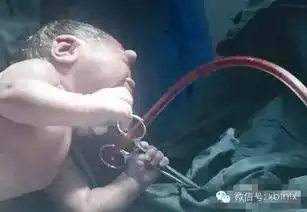 百年不遇的奇景新生儿一把握住医生剪刀
