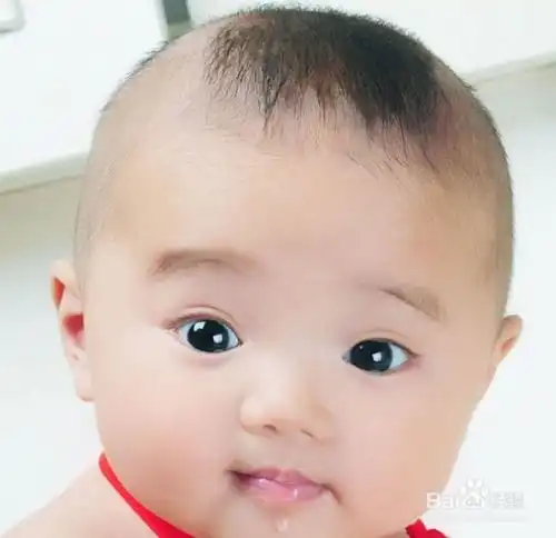 怎样预防湿疹复发如何预防宝宝湿疹复发
