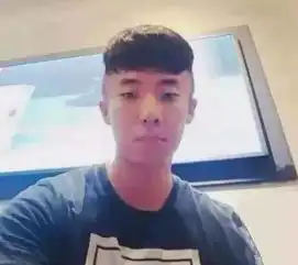 染发后脑袋肿成外星人,疑用劣质染发剂过程恐怖广州人你还敢染发吗
